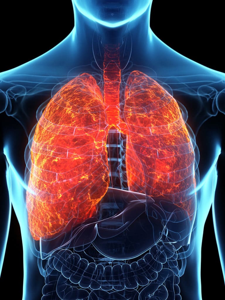 diffuse pleural thickening