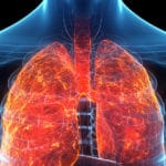 What are the health effects of exposure to asbestos?