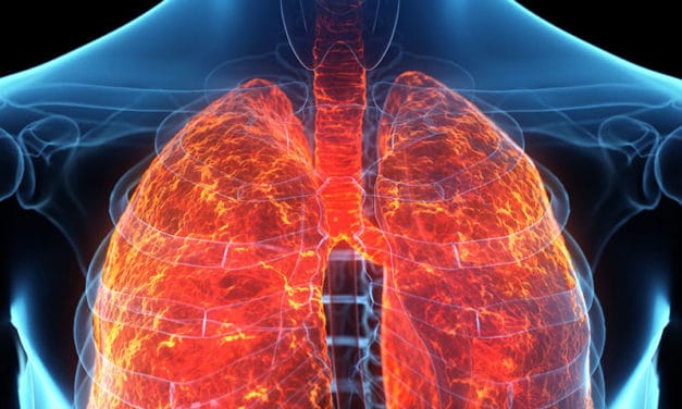What are the Symptoms of Asbestos Exposure?